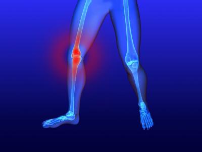 bolestivý kolenný kĺb